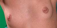 sexy tiny titties has puffy nipples